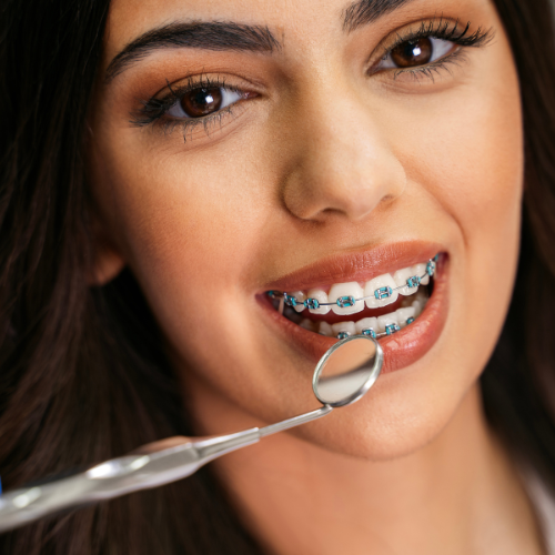 Quando Procurar um Aparelho Dentário?