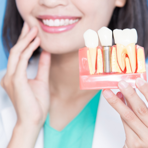 Tudo o Que Você Precisa Saber Sobre Implantes Dentários